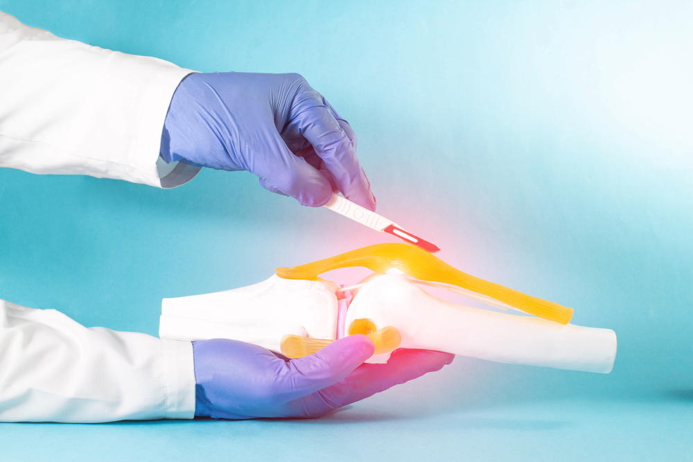 Doctor,surgeon,holds,a,scalpel,near,the,knee,joint,mockup